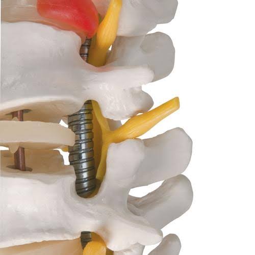 Highly Flexible Spine Model C42862